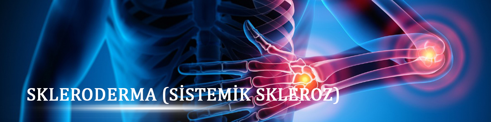 Skleroderma (Sistemik Skleroz) ve Raynaud Sendromu